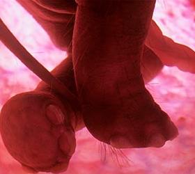 На Урале нашли еще три эмбриона