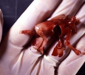 В Воронежской области на свалке обнаружили человеческий эмбрион