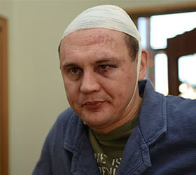 Бывший участник “Дома-2” Степан Меньщиков был жестоко избит